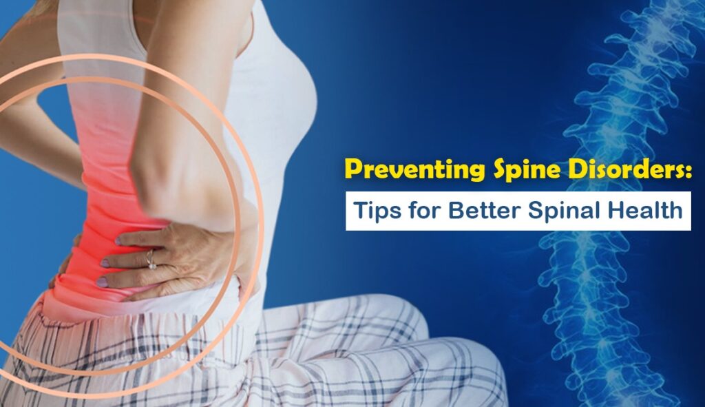Preventing Spine Disorders: Tips for Better Spinal Health